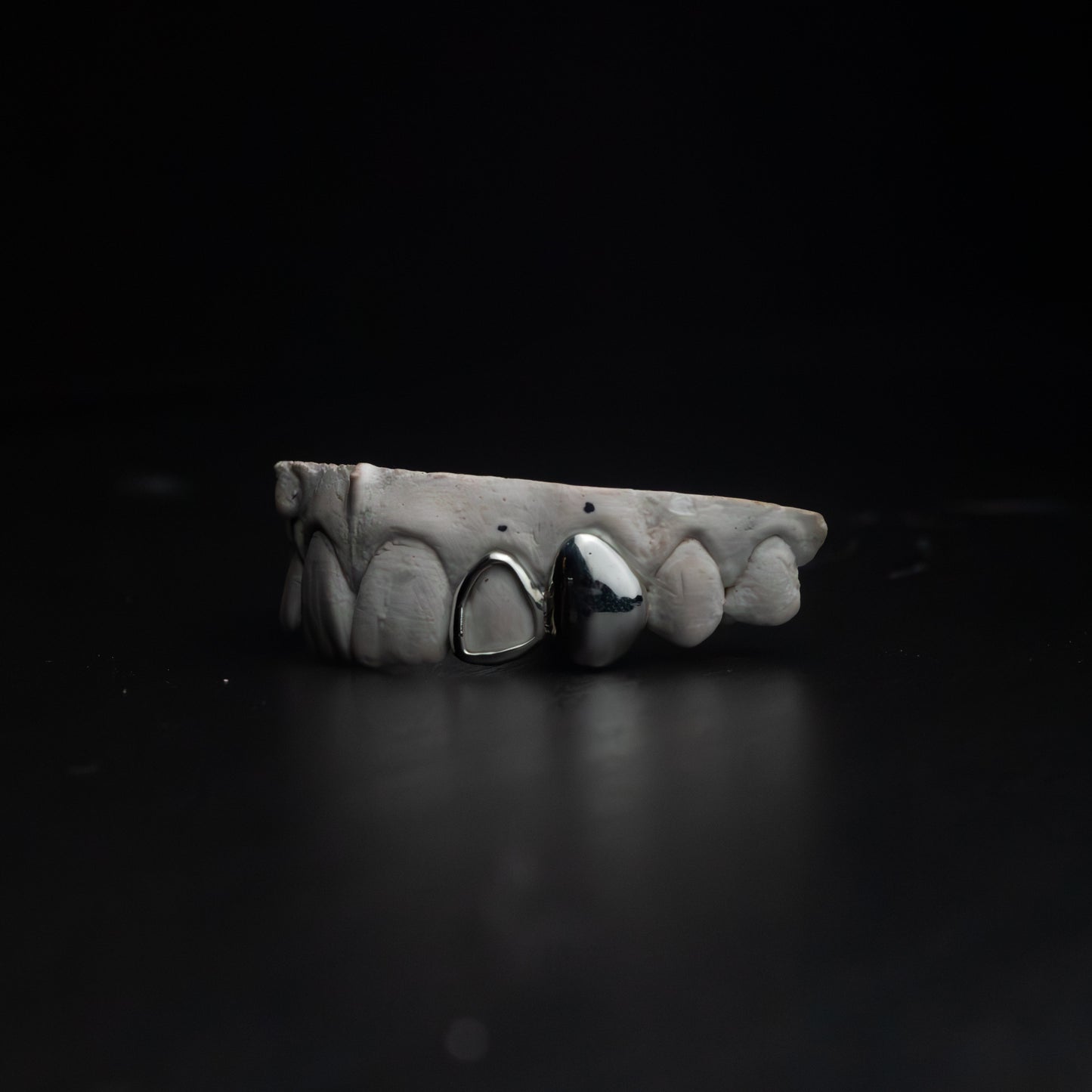 Lateral Window & Canine