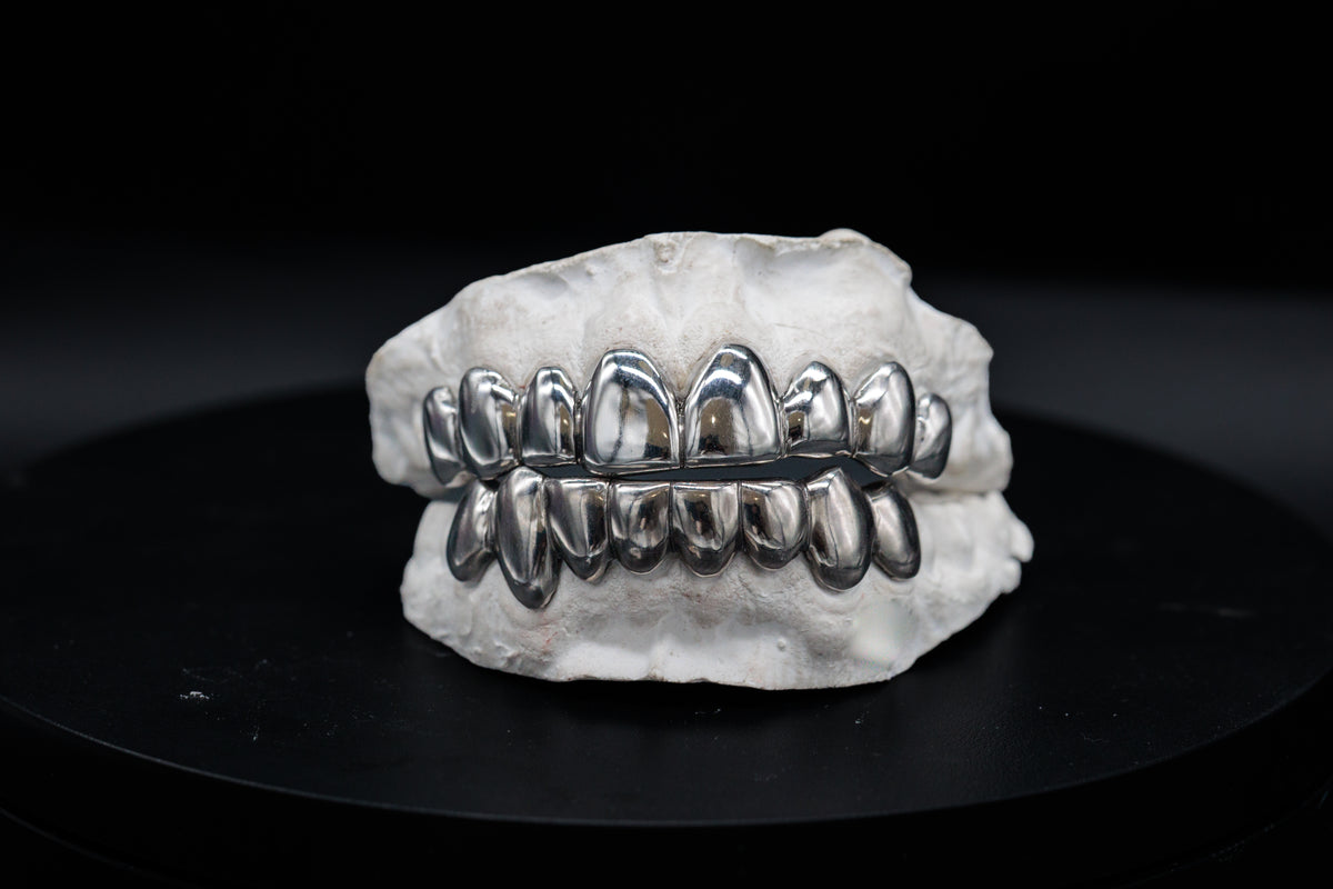 Full Top & Bottom 6 Grillz Set, Custom Gold Grillz by Noir Flare – view 3