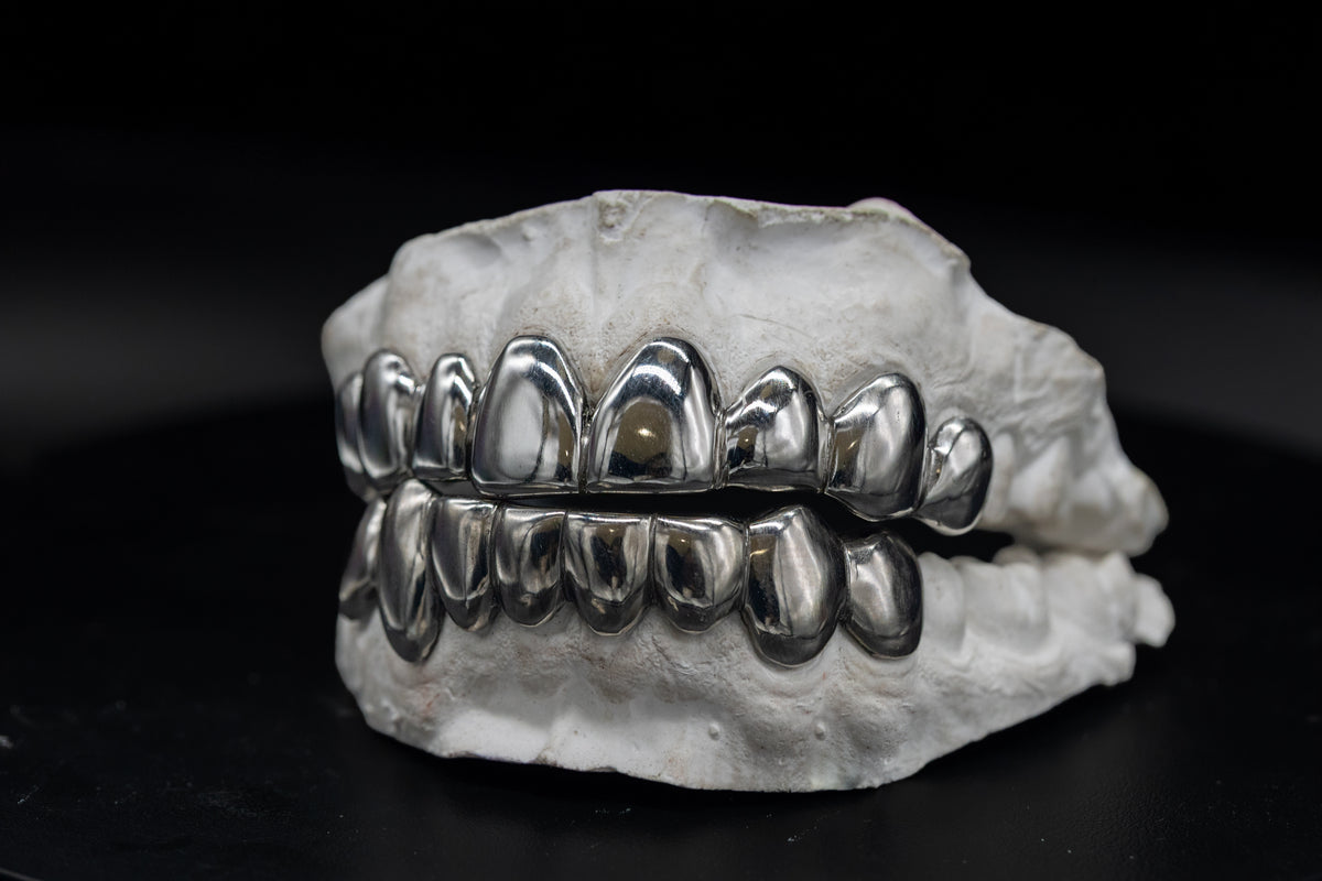 Full Top & Bottom 6 Grillz Set, Custom Gold Grillz by Noir Flare – view 2