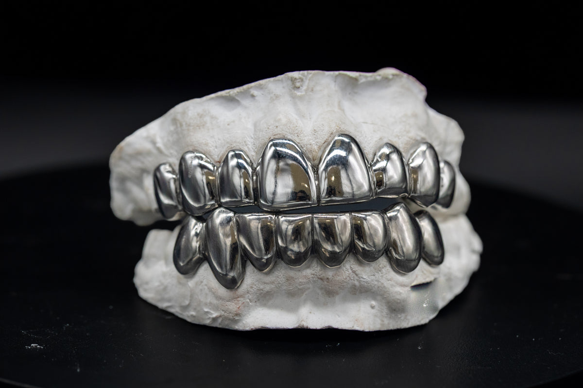 Full Top & Bottom 6 Grillz Set, Custom Gold Grillz by Noir Flare