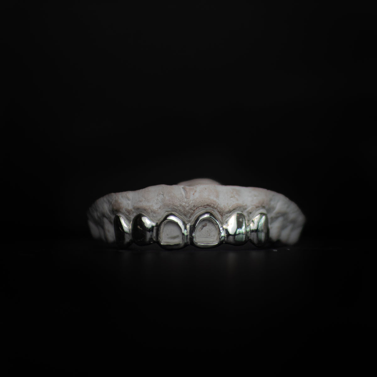 Middle Incisor 6-Tooth Grillz Set — Custom Gold Grillz by Noir Flare