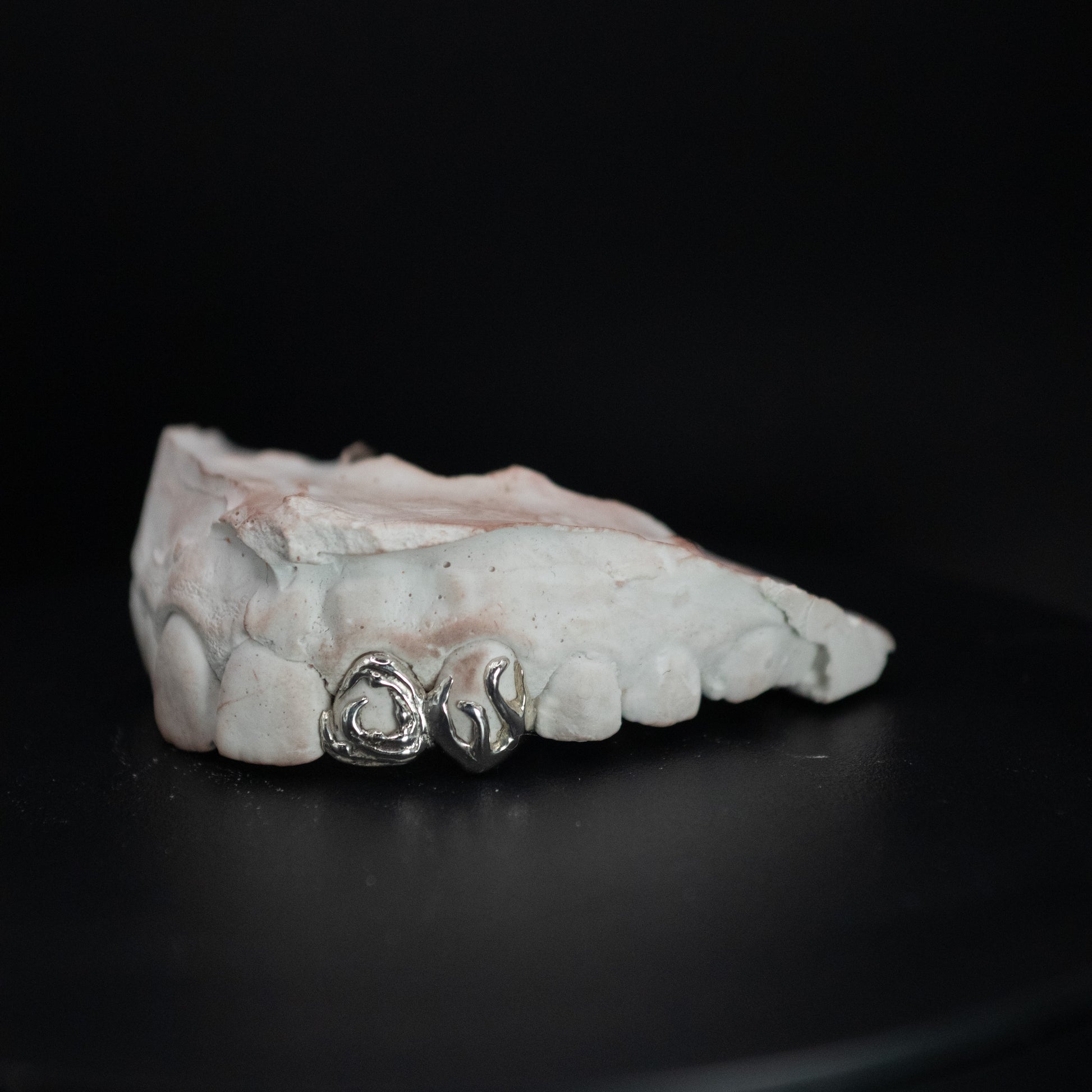 A set of silver and gold-coloured grillz with fire and water design on a dark background