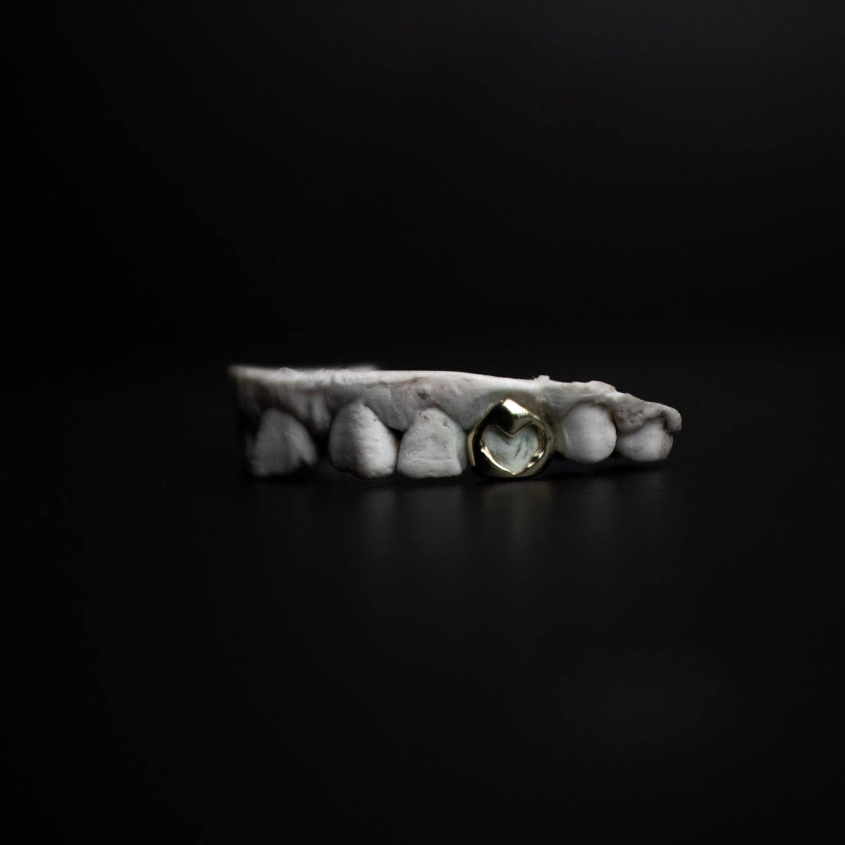 Window Heart Grillz — Custom Cut-Out Gold Tooth Cap by Noir Flare