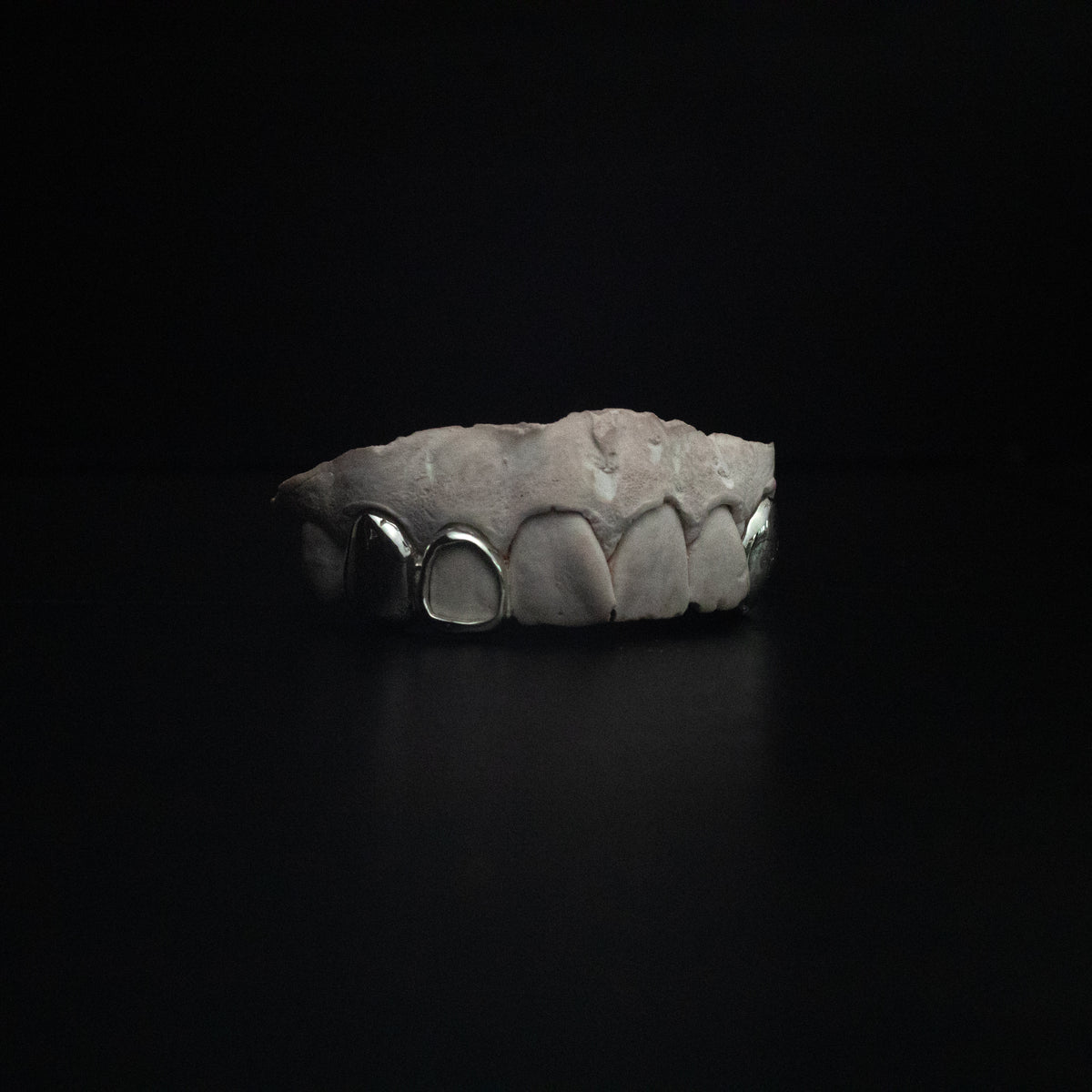Lateral, Window & Double Canine Grillz — Custom Gold Caps by Noir Flare