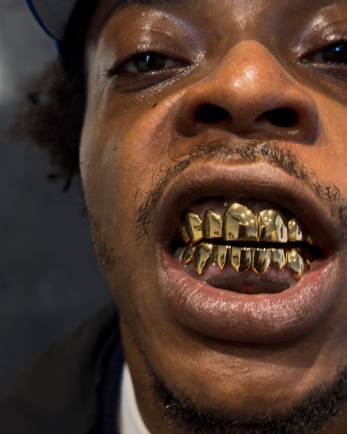 Full Top & Bottom 8 Grillz Set — Custom Gold Grillz by Noir Flare