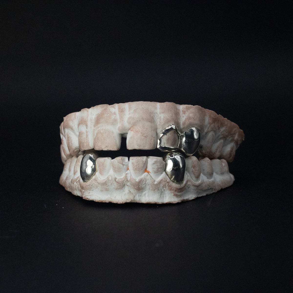 3 Canines & Window Grillz — Custom Gold Tooth Caps by Noir Flare