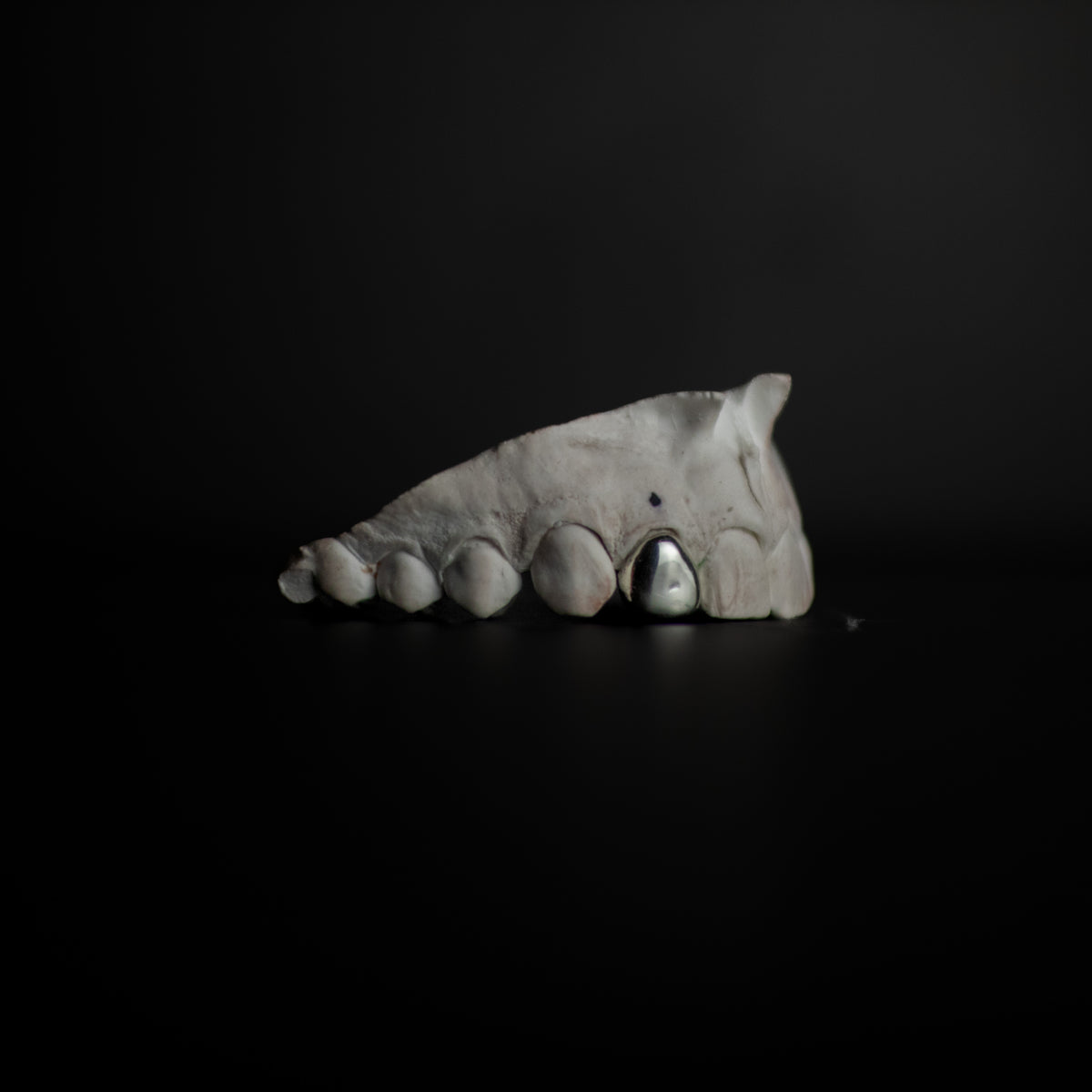 Single Tooth Grillz Cap — Custom Gold & Silver Grillz by Noir Flare