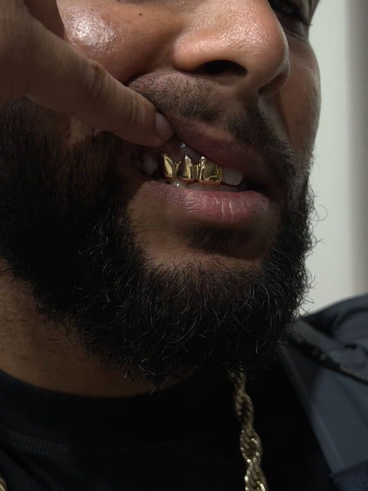 A close-up lifestyle shot of a man wearing gold grillz on his teeth, pointing at them with his finger. He is wearing a black t-shirt and a gray zippered jacket with 'GALLI DEP' printed on the chest.