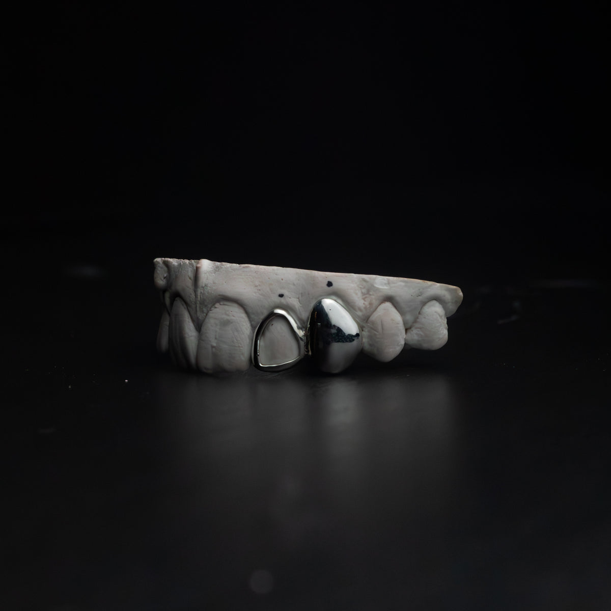 Lateral Window & Canine Grillz — Custom Gold Tooth Caps by Noir Flare